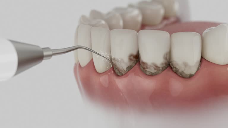 Trusted Invisalign Clear Aligners service in Crosspointe, VA - Dentist Open Now